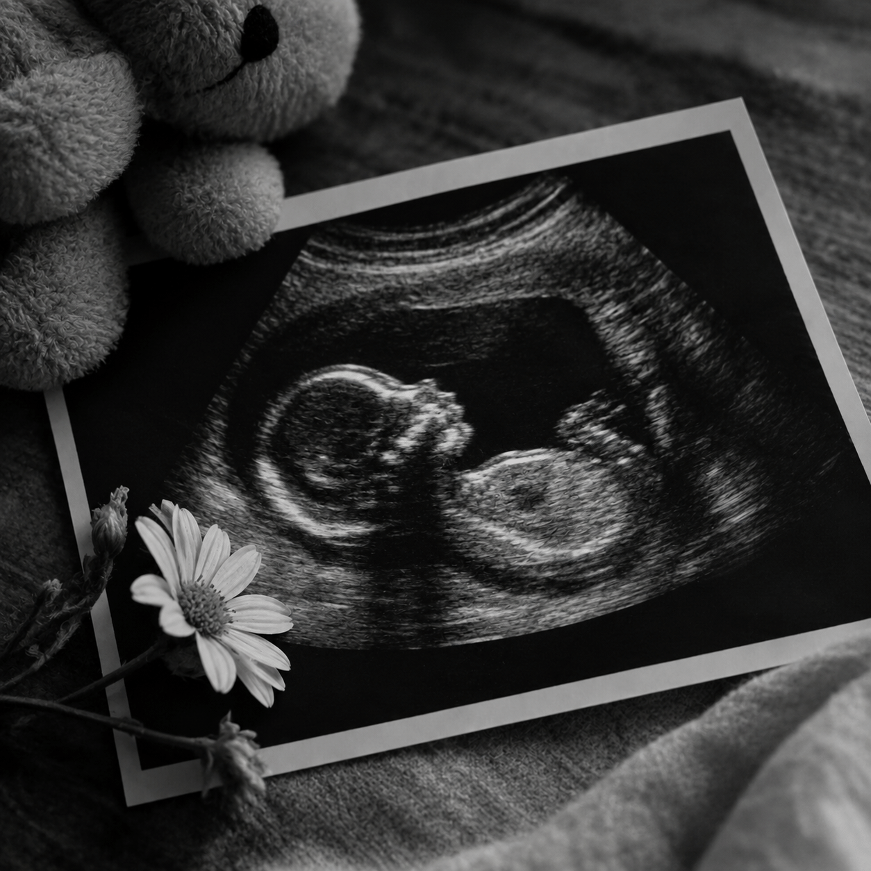 Abortus